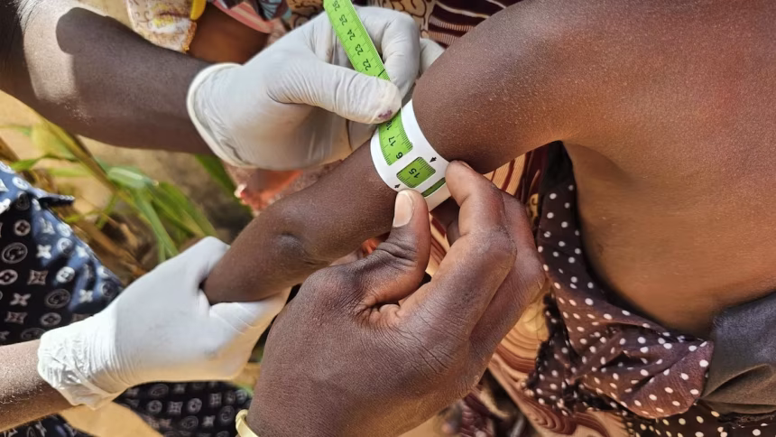 Niger Hospital Improves Recovery Rates for Children With Severe Malnutrition 1